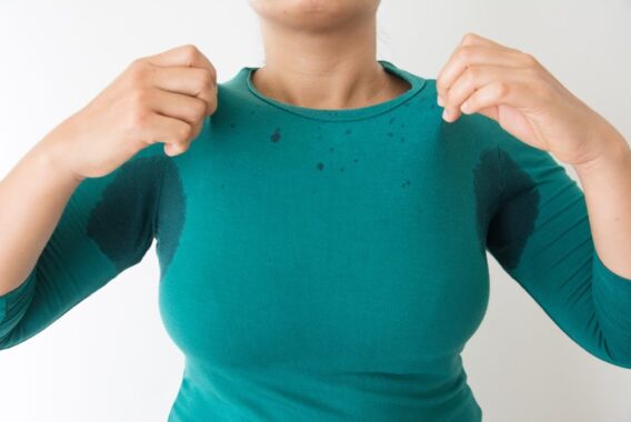 Don’t Have Sweat Stains in Your Holiday Pictures. Get a Hyperhidrosis Treatment