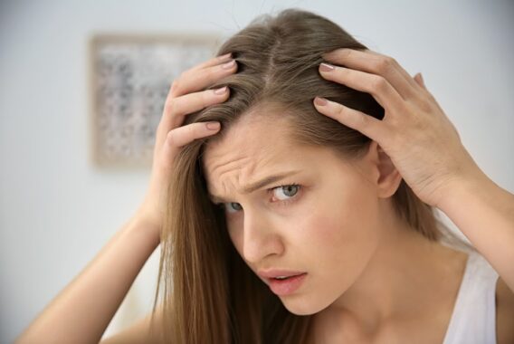 It’s Not the Holiday Stress, You May Have Alopecia. See How We Can Help