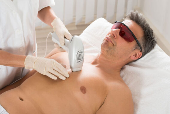 What to Know Before Your First Laser Hair Removal Treatment
