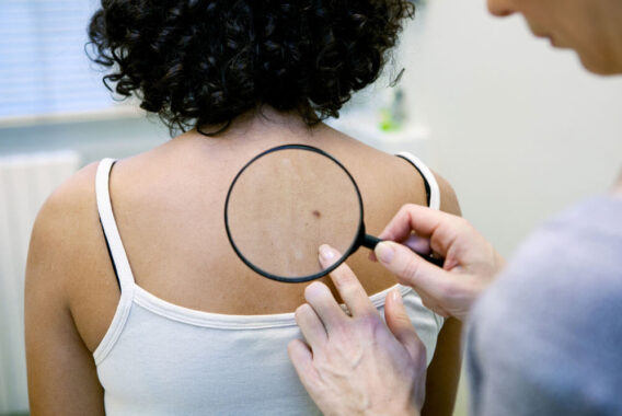 Why Skin Cancer Screenings are Key to Early Detection