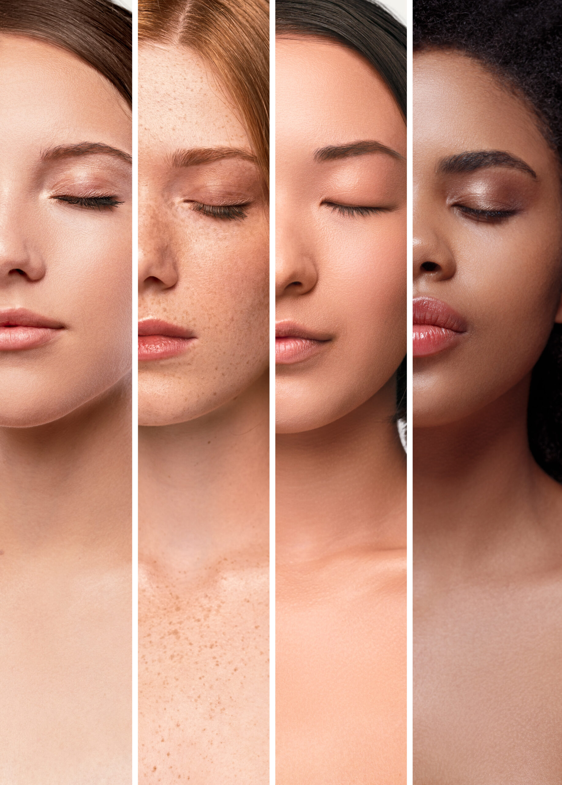 Understanding Fitzpatrick Skin Types: A Guide to Personalized Skin Care