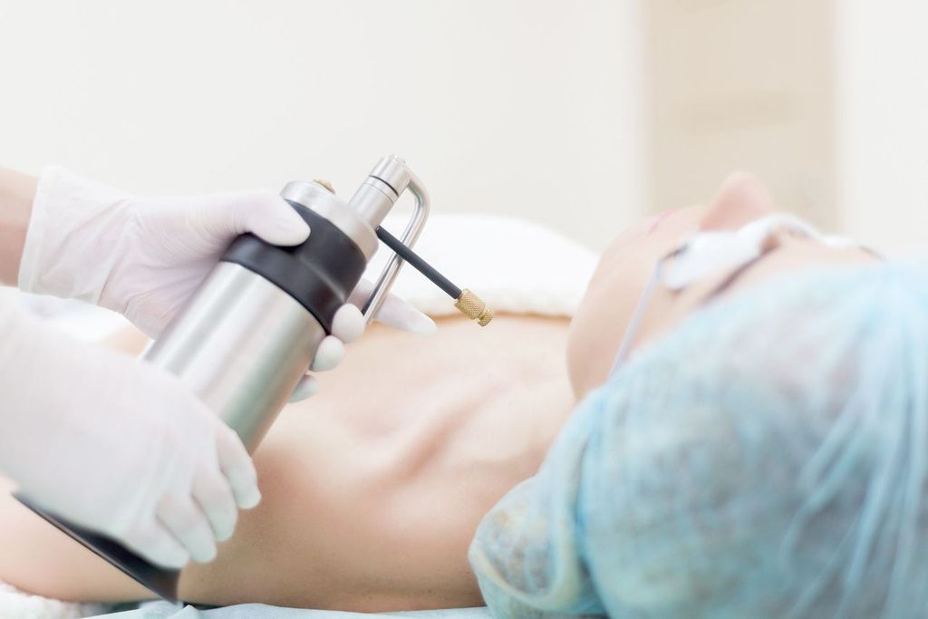 Cryotherapy_final - Welcome to DMSI - Professional Surgical Dermatology Services | Dermatology