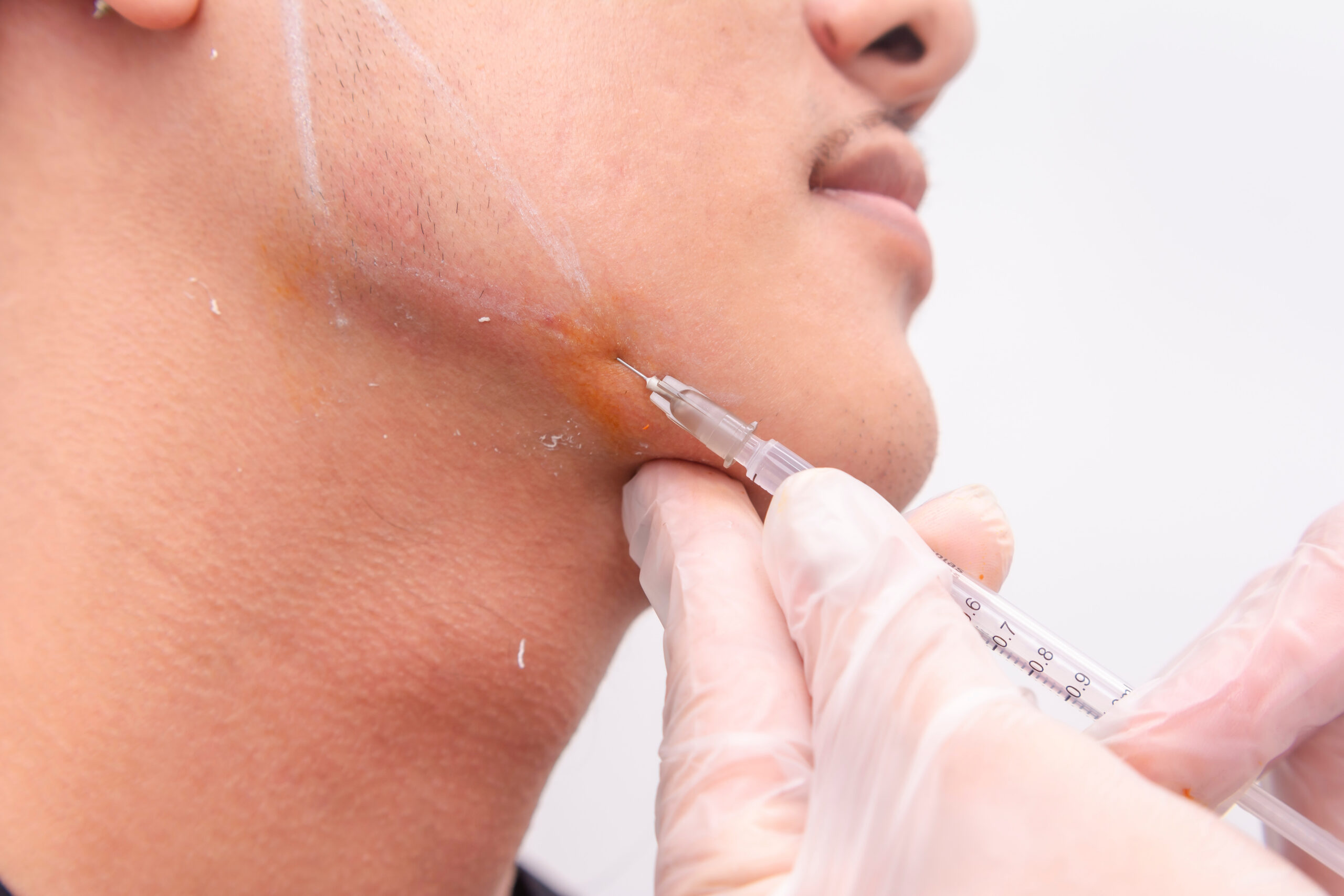Services Derm of Cape Cod